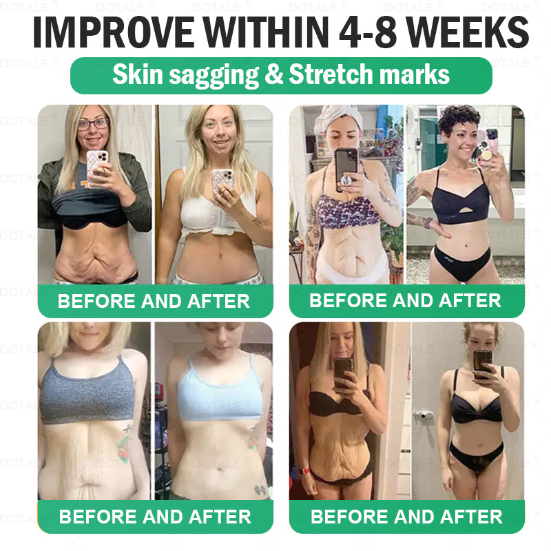 🇺🇸𝑫𝑶𝑻𝑨𝑳𝑬® 𝑵𝑨𝑫+ 𝑴𝒐𝒓𝒊𝒏𝒈𝒂 𝑩𝒆𝒓𝒃𝒆𝒓𝒊𝒏𝒆 𝑨𝑴𝑷𝑲 𝑺𝒖𝒑𝒑𝒐𝒓𝒕 𝑵𝒂𝒏𝒐 𝑴𝒊𝒄𝒓𝒐𝒏𝒆𝒆𝒅𝒍𝒆 𝑷𝒂𝒕𝒄𝒉🇺🇸 (𝐉𝐮𝐬𝐭 𝐨𝐧𝐜𝐞 𝐚 𝐝𝐚𝐲, 𝐯𝐢𝐬𝐢𝐛𝐥𝐞 𝐜𝐡𝐚𝐧𝐠𝐞𝐬 𝐢𝐧 𝟕 𝐝𝐚𝐲𝐬）𝙁𝙤𝙧𝙢𝙪𝙡𝙖 ✅ 𝐅𝐨𝐫 𝑺𝒖𝒑𝒑𝒐𝒓𝒕𝒔 𝑴𝒆𝒕𝒂𝒃𝒐𝒍𝒊𝒔𝒎, 𝑾𝒆𝒊𝒈𝒉𝒕 𝑴𝒂𝒏𝒂𝒈𝒆𝒎𝒆𝒏𝒕, 𝑯𝒆𝒂𝒓𝒕 𝑯𝒆𝒂𝒍𝒕𝒉,𝐨𝐛𝐞𝐬𝐢𝐭𝐲, 𝗟𝗼𝗼𝘀𝗲 𝘀𝗸𝗶𝗻,𝐝𝐢𝐚𝐛𝐞𝐭𝐞𝐬, 𝐬𝐥𝐞𝐞𝐩 𝐚𝐩𝐧𝐞𝐚, 𝐣𝐨𝐢𝐧𝐭 𝐢𝐬𝐬𝐮𝐞𝐬, 𝐚𝐧𝐝 𝐦𝐨𝐫𝐞