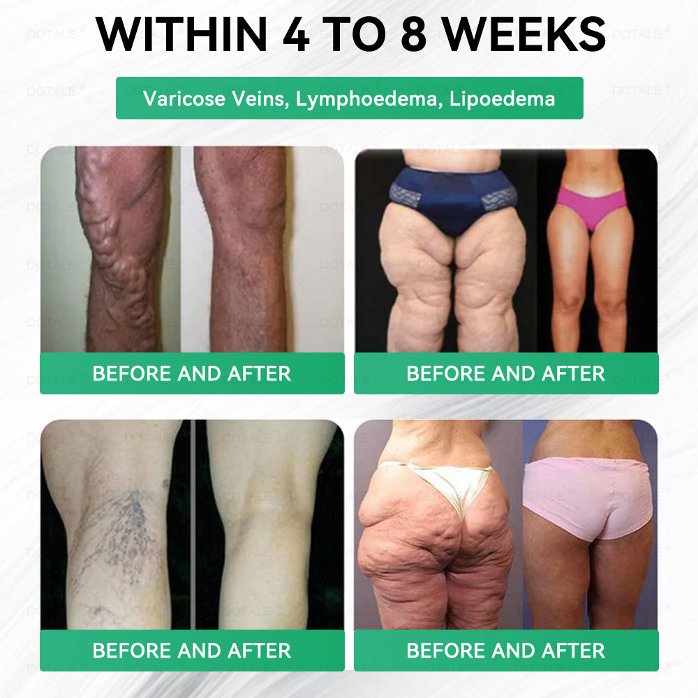 🇺🇸𝑫𝑶𝑻𝑨𝑳𝑬® 𝑵𝑨𝑫+ 𝑴𝒐𝒓𝒊𝒏𝒈𝒂 𝑩𝒆𝒓𝒃𝒆𝒓𝒊𝒏𝒆 𝑨𝑴𝑷𝑲 𝑺𝒖𝒑𝒑𝒐𝒓𝒕 𝑵𝒂𝒏𝒐 𝑴𝒊𝒄𝒓𝒐𝒏𝒆𝒆𝒅𝒍𝒆 𝑷𝒂𝒕𝒄𝒉🇺🇸 (𝐉𝐮𝐬𝐭 𝐨𝐧𝐜𝐞 𝐚 𝐝𝐚𝐲, 𝐯𝐢𝐬𝐢𝐛𝐥𝐞 𝐜𝐡𝐚𝐧𝐠𝐞𝐬 𝐢𝐧 𝟕 𝐝𝐚𝐲𝐬）𝙁𝙤𝙧𝙢𝙪𝙡𝙖 ✅ 𝐅𝐨𝐫 𝑺𝒖𝒑𝒑𝒐𝒓𝒕𝒔 𝑴𝒆𝒕𝒂𝒃𝒐𝒍𝒊𝒔𝒎, 𝑾𝒆𝒊𝒈𝒉𝒕 𝑴𝒂𝒏𝒂𝒈𝒆𝒎𝒆𝒏𝒕, 𝑯𝒆𝒂𝒓𝒕 𝑯𝒆𝒂𝒍𝒕𝒉,𝐨𝐛𝐞𝐬𝐢𝐭𝐲, 𝗟𝗼𝗼𝘀𝗲 𝘀𝗸𝗶𝗻,𝐝𝐢𝐚𝐛𝐞𝐭𝐞𝐬, 𝐬𝐥𝐞𝐞𝐩 𝐚𝐩𝐧𝐞𝐚, 𝐣𝐨𝐢𝐧𝐭 𝐢𝐬𝐬𝐮𝐞𝐬, 𝐚𝐧𝐝 𝐦𝐨𝐫𝐞