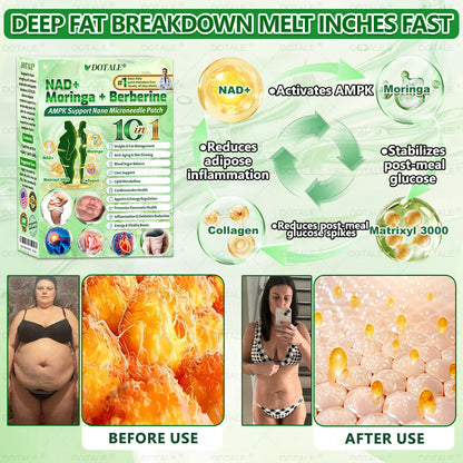 🇺🇸𝑫𝑶𝑻𝑨𝑳𝑬® 𝑵𝑨𝑫+ 𝑴𝒐𝒓𝒊𝒏𝒈𝒂 𝑩𝒆𝒓𝒃𝒆𝒓𝒊𝒏𝒆 𝑨𝑴𝑷𝑲 𝑺𝒖𝒑𝒑𝒐𝒓𝒕 𝑵𝒂𝒏𝒐 𝑴𝒊𝒄𝒓𝒐𝒏𝒆𝒆𝒅𝒍𝒆 𝑷𝒂𝒕𝒄𝒉🇺🇸 (𝐉𝐮𝐬𝐭 𝐨𝐧𝐜𝐞 𝐚 𝐝𝐚𝐲, 𝐯𝐢𝐬𝐢𝐛𝐥𝐞 𝐜𝐡𝐚𝐧𝐠𝐞𝐬 𝐢𝐧 𝟕 𝐝𝐚𝐲𝐬）𝙁𝙤𝙧𝙢𝙪𝙡𝙖 ✅ 𝐅𝐨𝐫 𝑺𝒖𝒑𝒑𝒐𝒓𝒕𝒔 𝑴𝒆𝒕𝒂𝒃𝒐𝒍𝒊𝒔𝒎, 𝑾𝒆𝒊𝒈𝒉𝒕 𝑴𝒂𝒏𝒂𝒈𝒆𝒎𝒆𝒏𝒕, 𝑯𝒆𝒂𝒓𝒕 𝑯𝒆𝒂𝒍𝒕𝒉,𝐨𝐛𝐞𝐬𝐢𝐭𝐲, 𝗟𝗼𝗼𝘀𝗲 𝘀𝗸𝗶𝗻,𝐝𝐢𝐚𝐛𝐞𝐭𝐞𝐬, 𝐬𝐥𝐞𝐞𝐩 𝐚𝐩𝐧𝐞𝐚, 𝐣𝐨𝐢𝐧𝐭 𝐢𝐬𝐬𝐮𝐞𝐬, 𝐚𝐧𝐝 𝐦𝐨𝐫𝐞